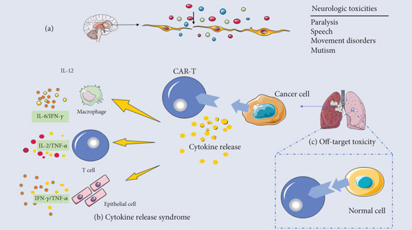Common side effects of CAR-T cell therapy