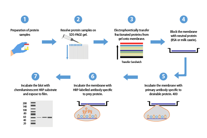 All you need to know about the Western Blots and their importance in protein detection | HHC